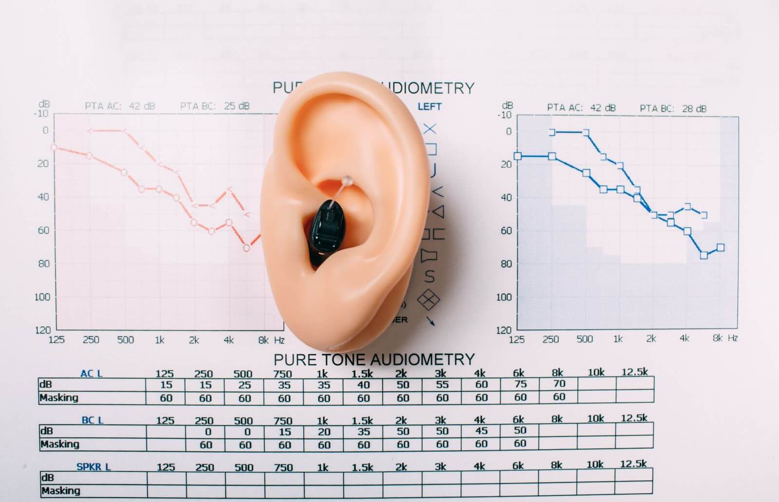 Featured image for “Hearing Aids and Tinnitus”